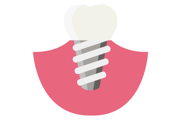 Tooth Implant Dental Medical Treatment: Embroidery Review