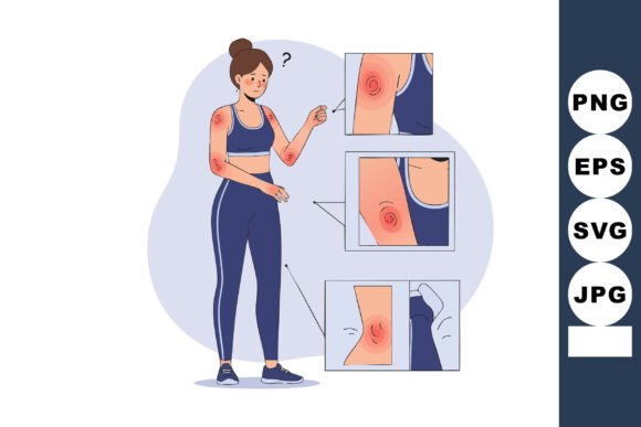 Woman with Skin Rash and Irritation